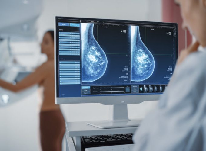 Breast cancer diagnosis: The lessons that should be learned