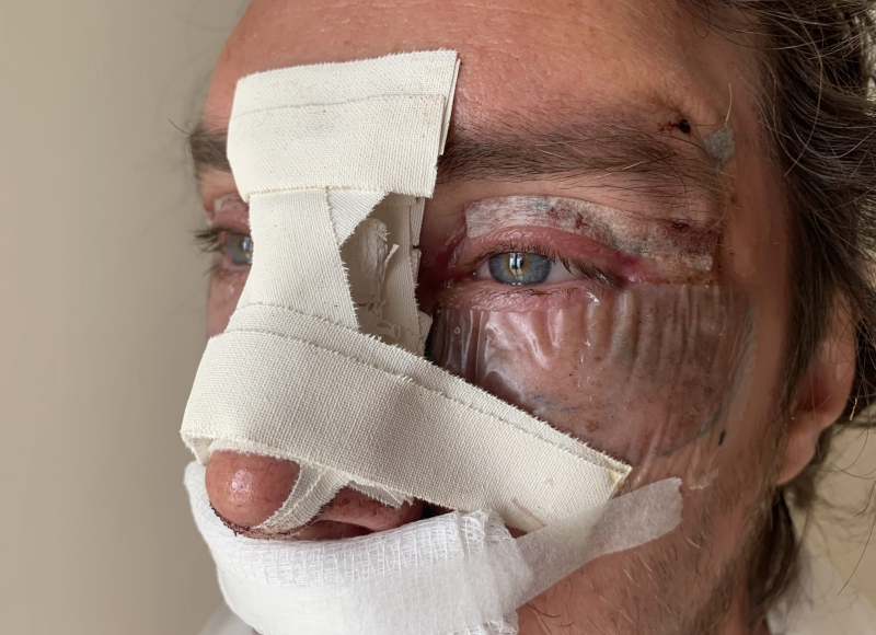 Serious Injury Claims
