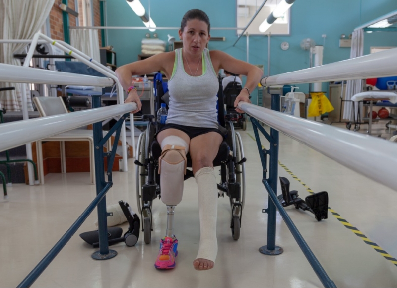 Serious Injury Claims