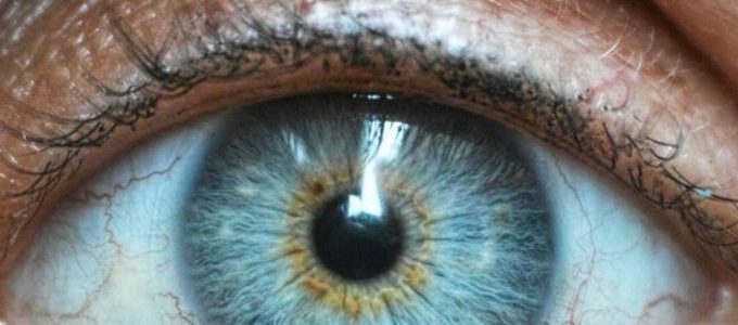 Glaucoma missed diagnosis
