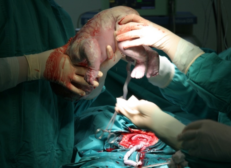 Clinical Negligence